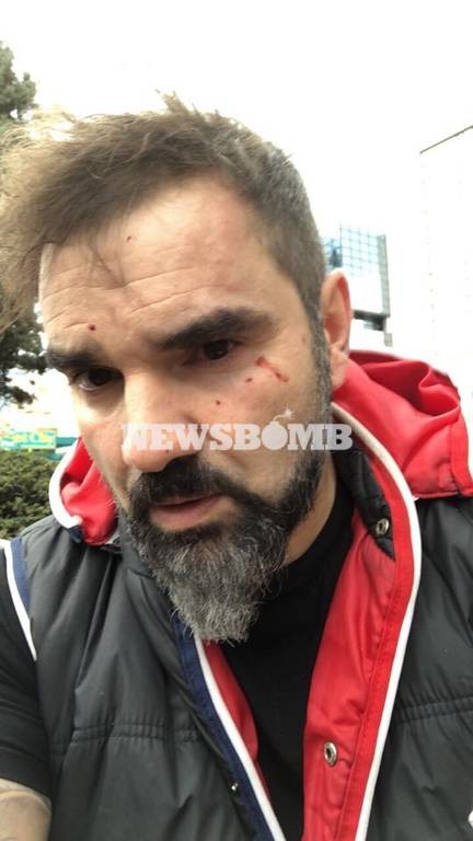 Εκτακτο: Θύμα δολοφονικής επίθεσης ο Νάσος Γουμενίδης (video+pics)