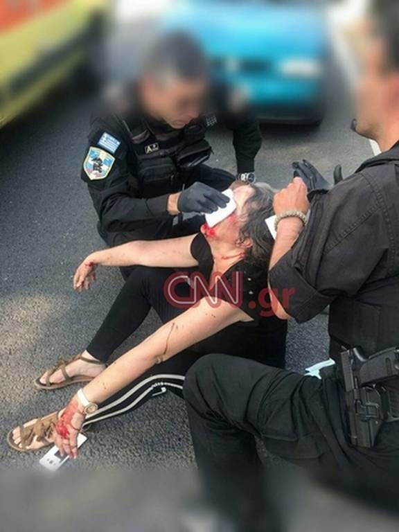 Πολύ σκληρές εικόνες: Αστυνομικοί της ΔΙΑΣ σώζουν έγκυο γυναίκα από τροχαίο! (pics)