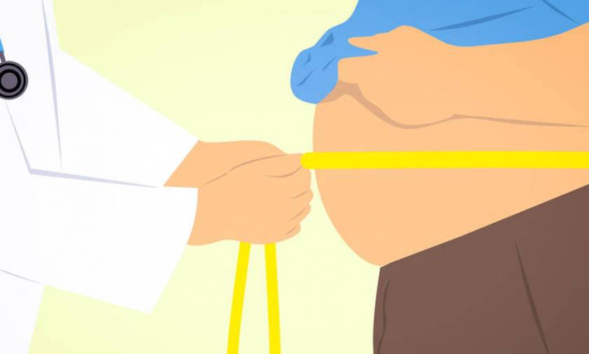 Δώδεκα μορφές καρκίνου συνδέονται με την παχυσαρκία