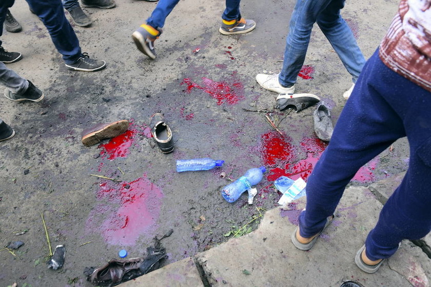 Πανικός σε πολιτική συγκέντρωση από έκρηξη χειροβομβίδας – Τουλάχιστον 83 τραυματίες (Pics)