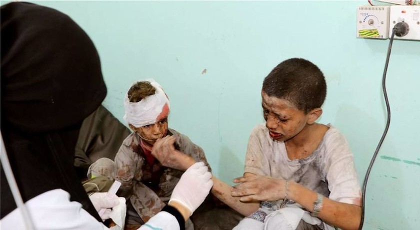 Μακελειό Υεμένη: Άμεση ανεξάρτητη έρευνα για τη σφαγή των παιδιών διέταξε ο ΟΗΕ (ΣΚΛΗΡΕΣ ΕΙΚΟΝΕΣ)