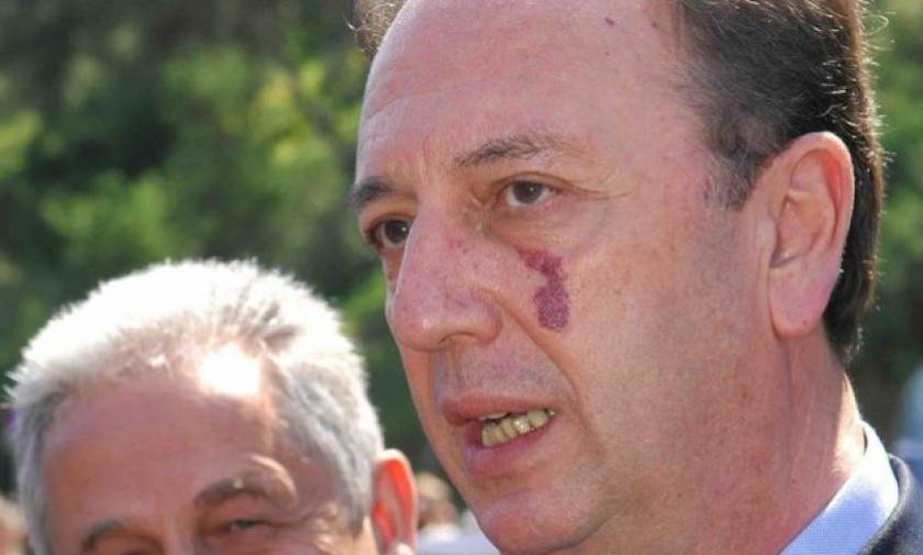 Πέθανε ο πρώην υπουργός Γιώργος Καλός