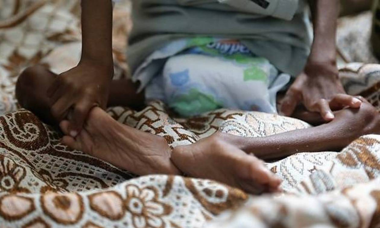«Καμπανάκι» του ΟΗΕ για τον λιμό στην Υεμένη: Πλησιάζουμε ένα σημείο χωρίς επιστροφή