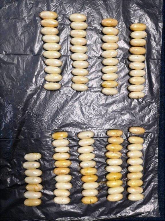 «Ελ. Βενιζέλος»: Ήρθε από το Σάο Πάολο με 87 κάψουλες κοκαΐνης στο στομάχι (pic)