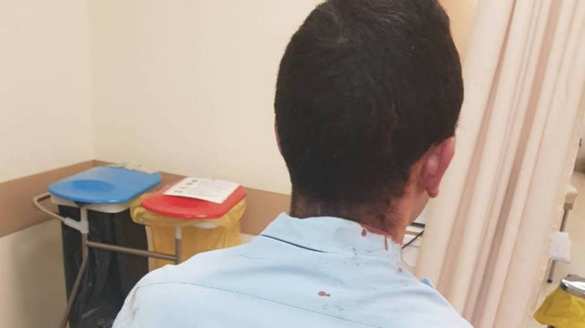 Αστυνομικοί με τραύματα σε κεφάλι και χέρια μετά από επίθεση Ρομά - Δείτε τις φωτογραφίες