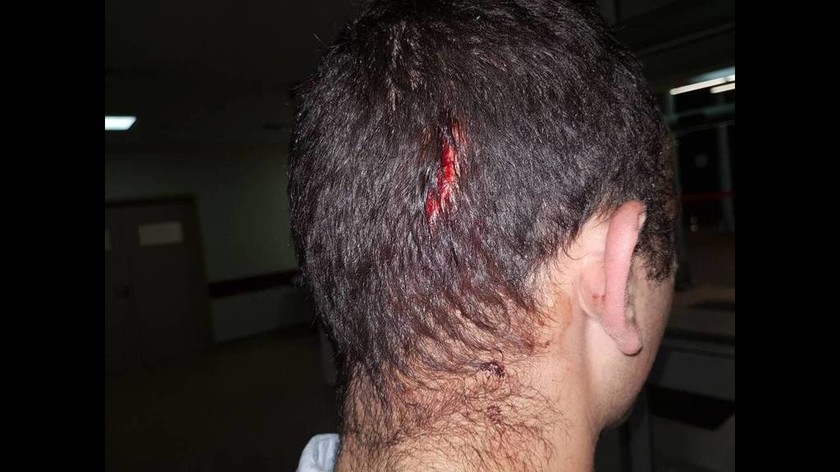 Βίντεο ντοκουμέντο από την άγρια επίθεση κατά των αστυνομικών στην Πειραιώς 