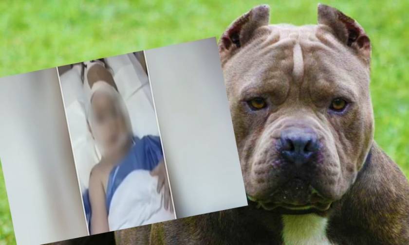Επίθεση σκύλου σε κοριτσάκι 3 ετών: Η ζωοφιλία του χαβαλέ οδηγεί σε δράματα