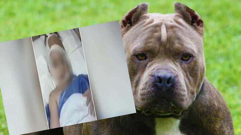 Επίθεση σκύλου σε κοριτσάκι 3 ετών: Η ζωοφιλία του χαβαλέ οδηγεί σε δράματα 