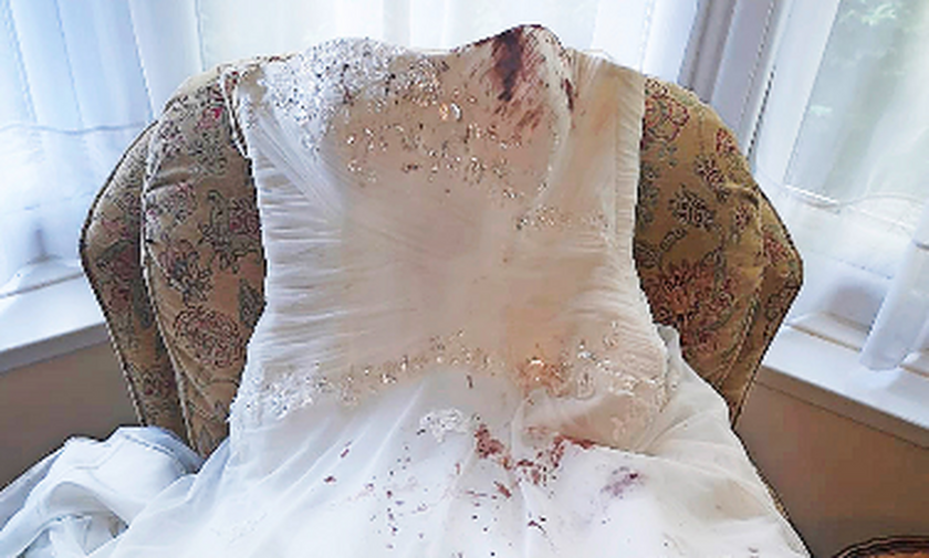 Γάμος - εφιάλτης: Το νυφικό γέμισε με αίματα (pics)