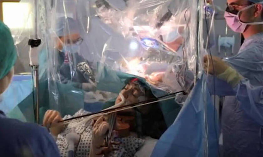 Απίστευτο: Ασθενής παίζει βιολί την ώρα που χειρουργείται στον εγκέφαλο