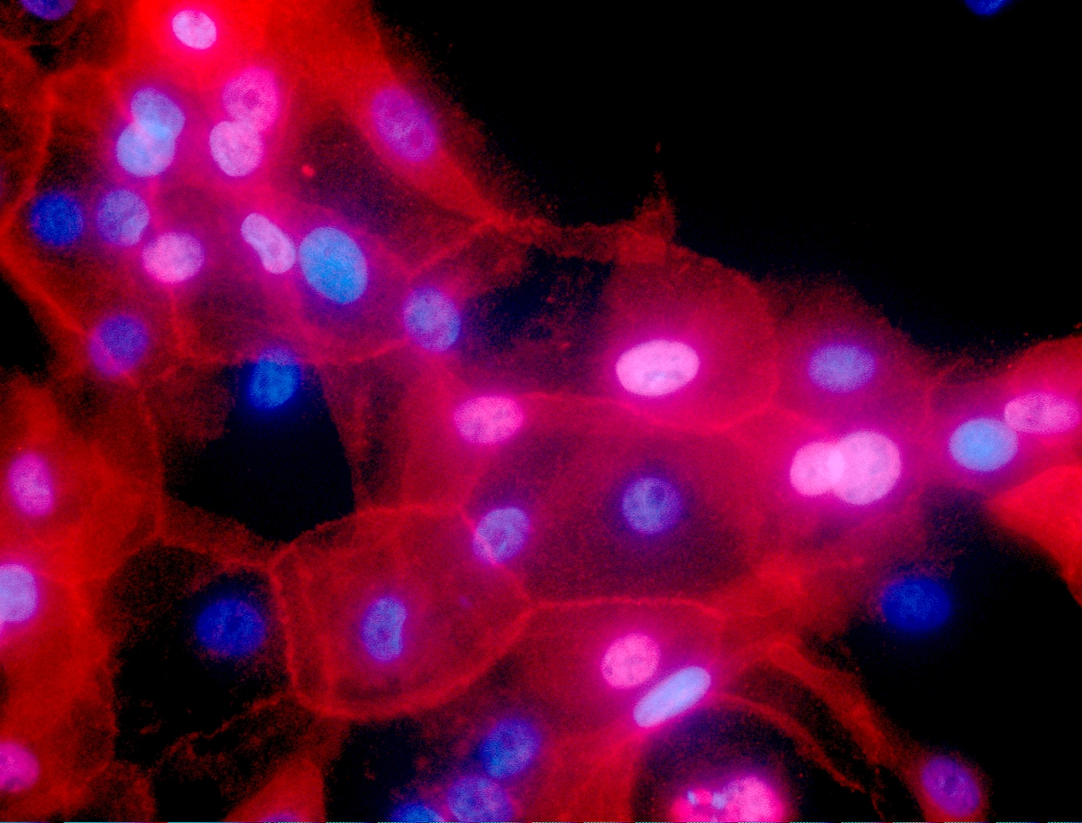 AP_breast-cancer-gene.jpg