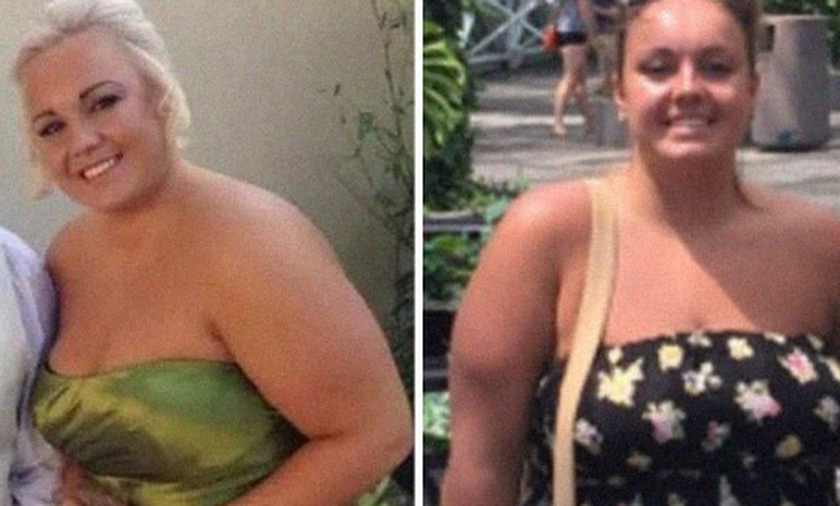 Τρομακτική μεταμόρφωση: 26χρονη έχασε 50 κιλά – Δείτε πώς έγινε