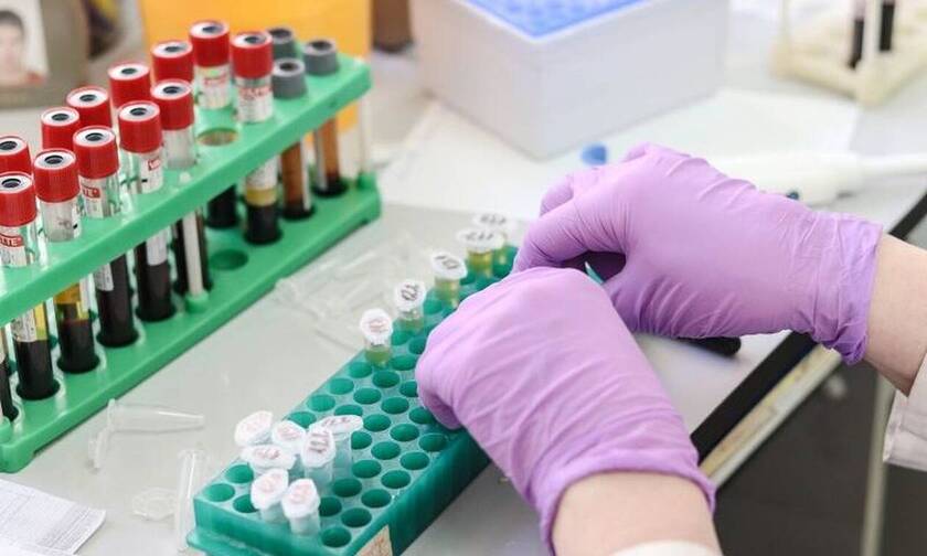 Κορονοϊός Ρωσία: Δοκιμάζονται ήδη έξι εμβόλια κατά του ιού ανακοίνωσε ο πρωθυπουργός