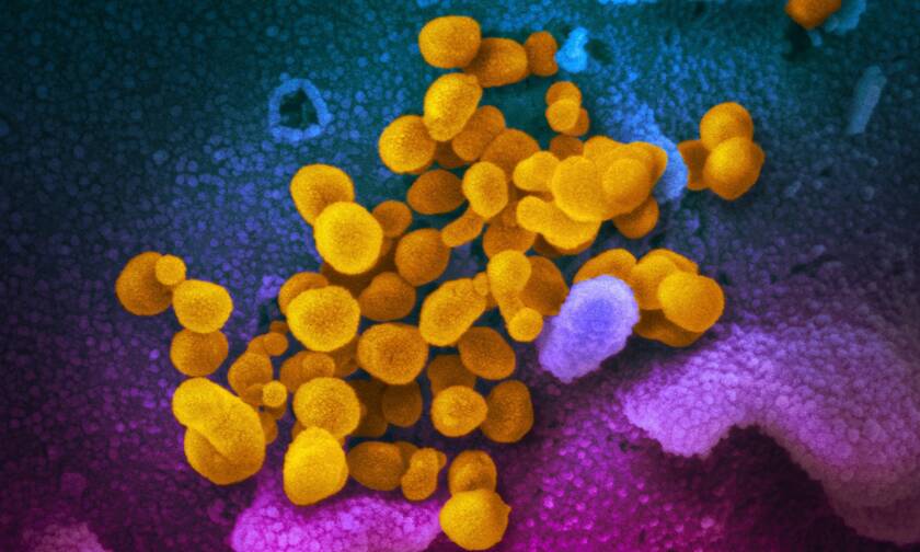 Κορονοϊός: Τι είναι το μονοκλωνικό αντίσωμα και γιατί δίνει ελπίδα στη μάχη κατά του φονικού ιού