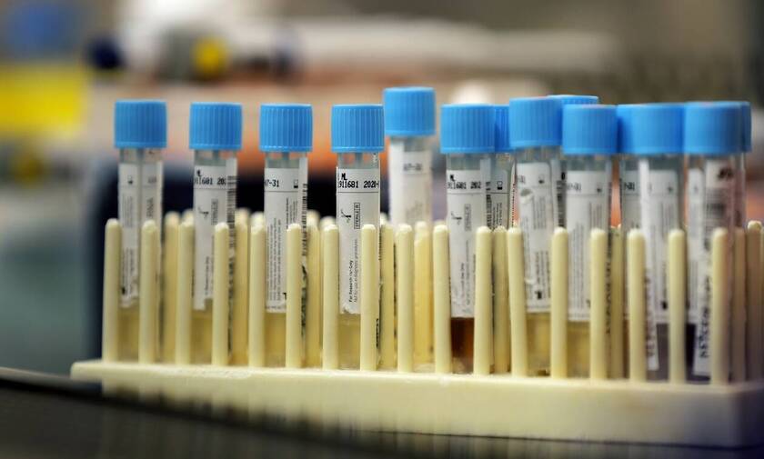 Κορονοϊός ΗΠΑ: Ξεκινάει σύντομα η δεύτερη φάση δοκιμών πειραματικού εμβολίου