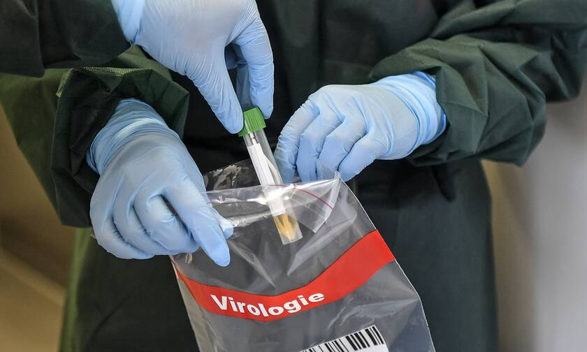 Κορονοϊός: Εγκρίθηκε το πρώτο κατ' οίκον μοριακό τεστ στις ΗΠΑ - Πώς ανιχνεύει τον ιό 