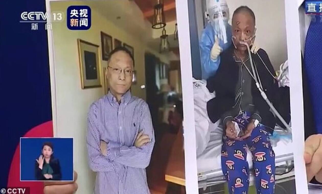 Κίνα: Αποκτά ξανά το χρώμα του ο γιατρός που έγινε «μαύρος» λόγω κορονοϊού (pics)