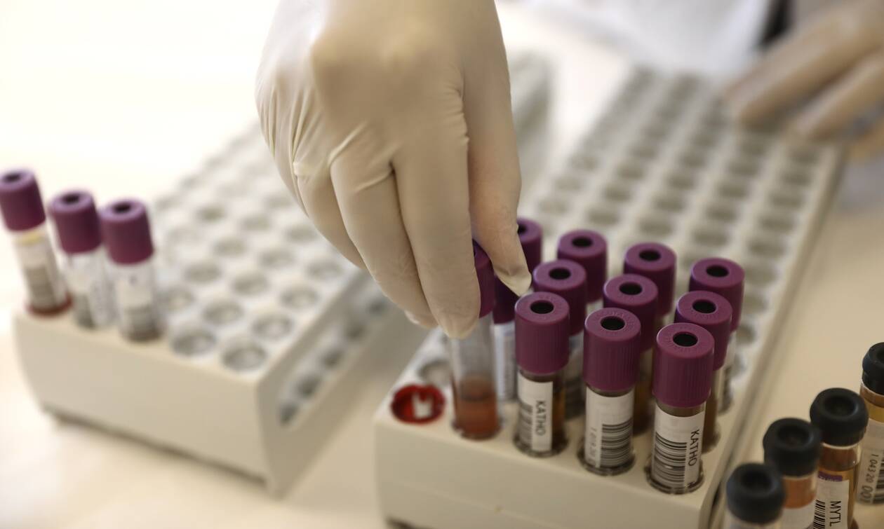 Κορονοϊός-Έρευνα σοκ: Αυτή ομάδα αίματος κινδυνεύει περισσότερο από τον ιό