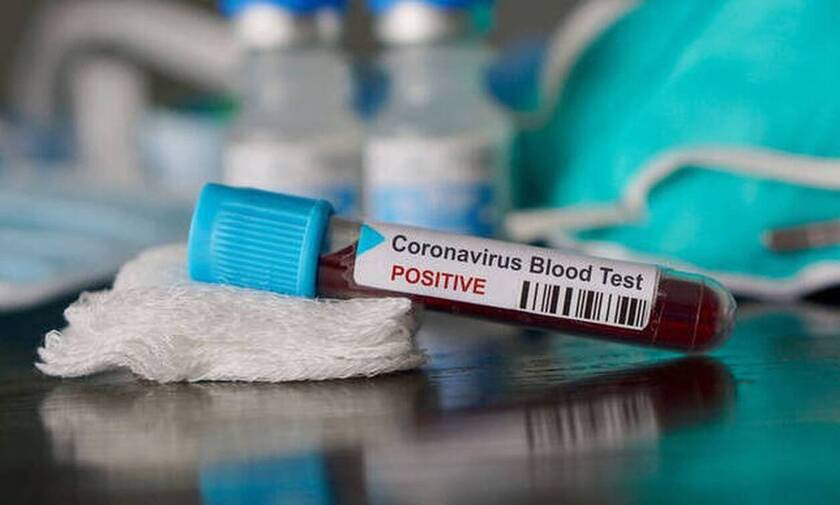 Greece: 20 new coronavirus cases, 1 death