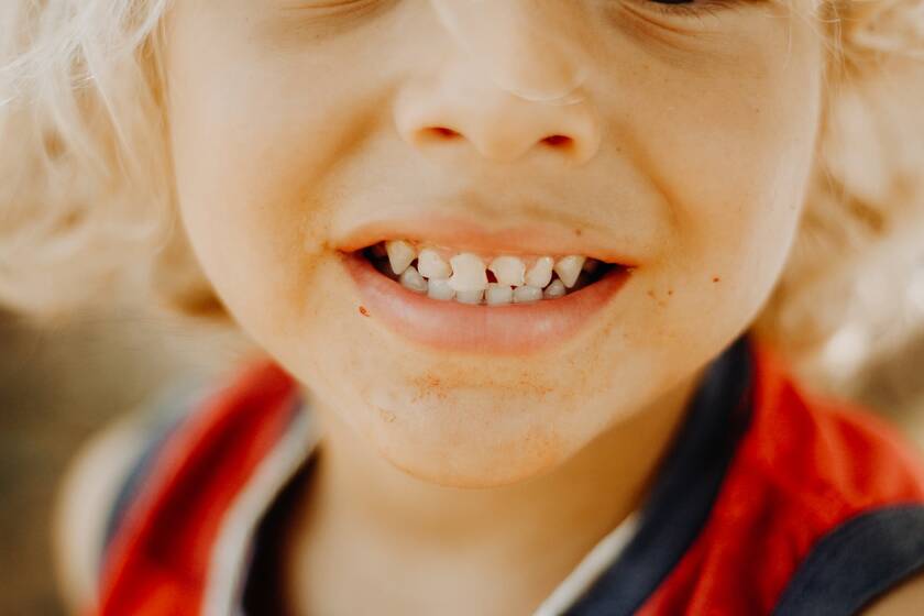 Το παιδί έσπασε το δόντι του; Δείτε τι πρέπει να κάνετε 