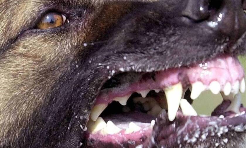 Σοκ στη Θεσσαλονίκη: 58 δαγκωματιές από αγέλη σκύλων δέχτηκε 17χρονη