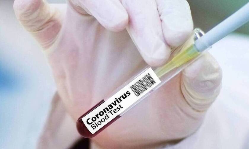 Γαλλία – Κρονοϊός: Sanofi και GSK θα δώσουν έως 72 εκατ δόσεις του εμβολίου τους στον Καναδά