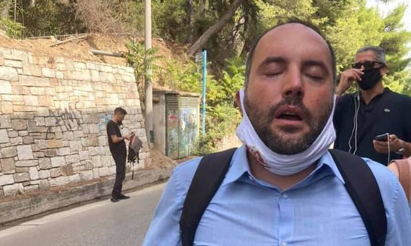 Δίκη Χρυσής Αυγής: Στο νοσοκομείο βουλευτής του ΣΥΡΙΖΑ μετά από τα επεισόδια στο Εφετείο
