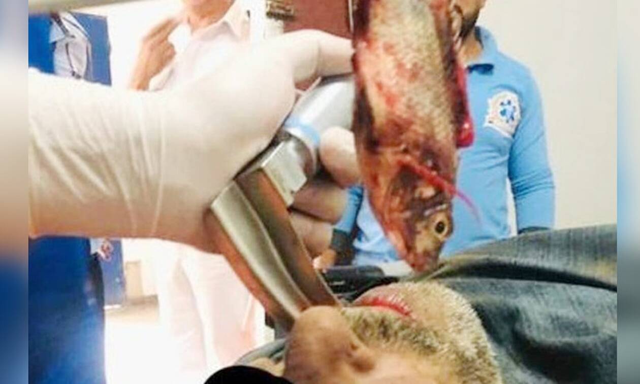 Τρομακτικό ατύχημα: Ζωντανό ψάρι σφήνωσε στον λαιμό ψαρά – Σκληρές εικόνες! (vid)