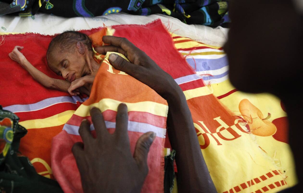 ΟΗΕ: Έκθεση-σοκ με φόντο την πανδημία- 30 εκατομμύρια άνθρωποι στα όρια της λιμοκτονίας
