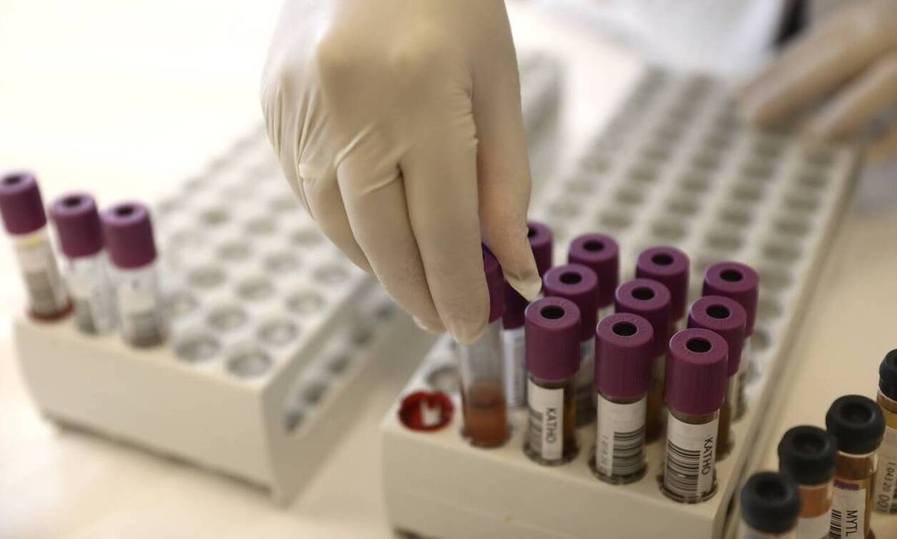 Κορονοϊός: Επηρεάζει η ομάδα αίματος τον ιό; Τι ανακάλυψαν οι επιστήμονες