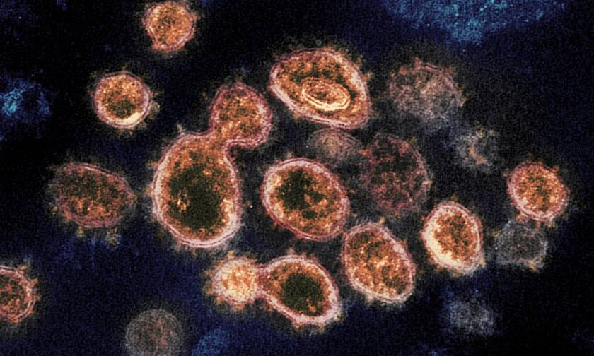 Τα σωματίδια του ιού SARS-CoV-2 που προκαλούν COVID-19