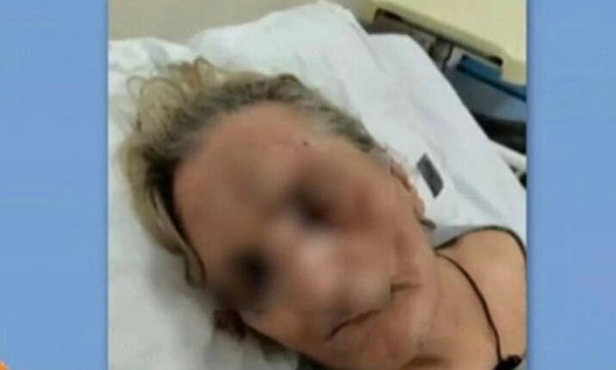 Τζάνειο: Αποκλειστική νοσοκόμα ξυλοκόπησε ηλικιωμένη - Συγκλονίζουν οι εικόνες