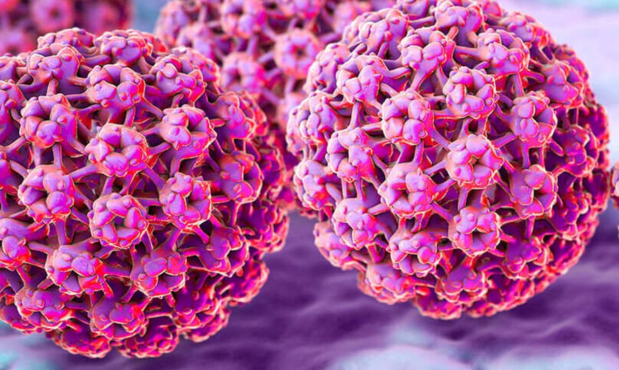 HPV: 100 τύποι του ιού ζητούν θεραπεία - Ο εμβολιασμός μπορεί να εμποδίσει τη λοίμωξη