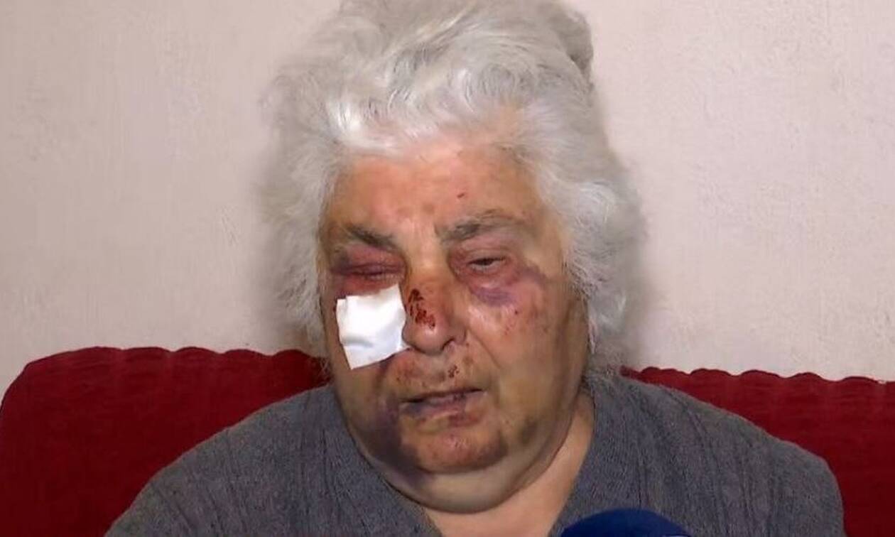 Ασπρόπυργος: Τρόμος για ηλικιωμένη από ληστές που της επιτέθηκαν - «Θα με σκότωναν»