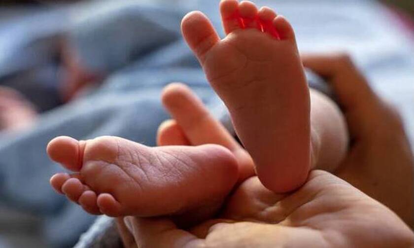 Μωρό γεννήθηκε με δύο κεφάλια στην Ινδία