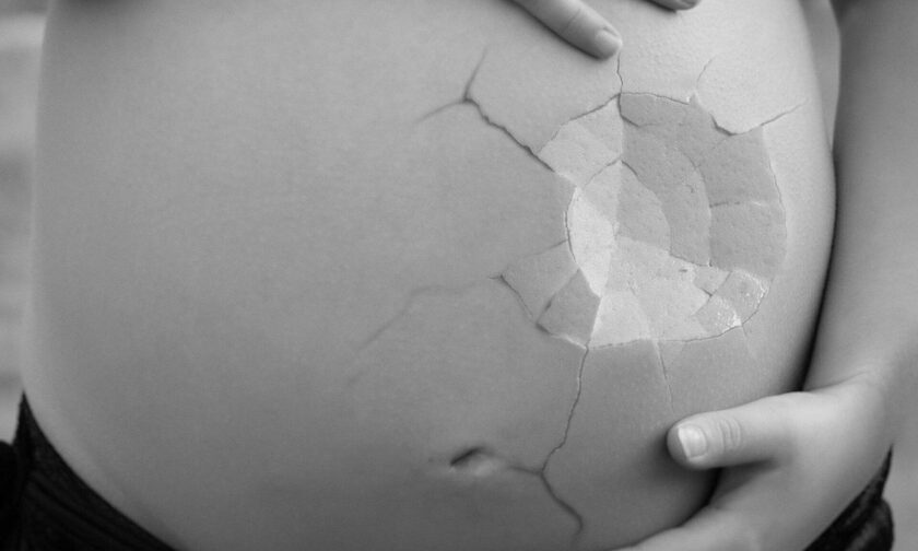 Αδιανόητο: Λήστεψε και χτύπησε έγκυο προκαλώντας της αποβολή