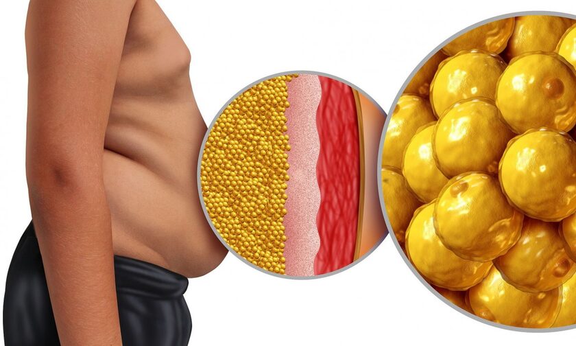 Ποιες τροφές ευθύνονται για την παχυσαρκία - Ο ρόλος των πρωτεϊνών