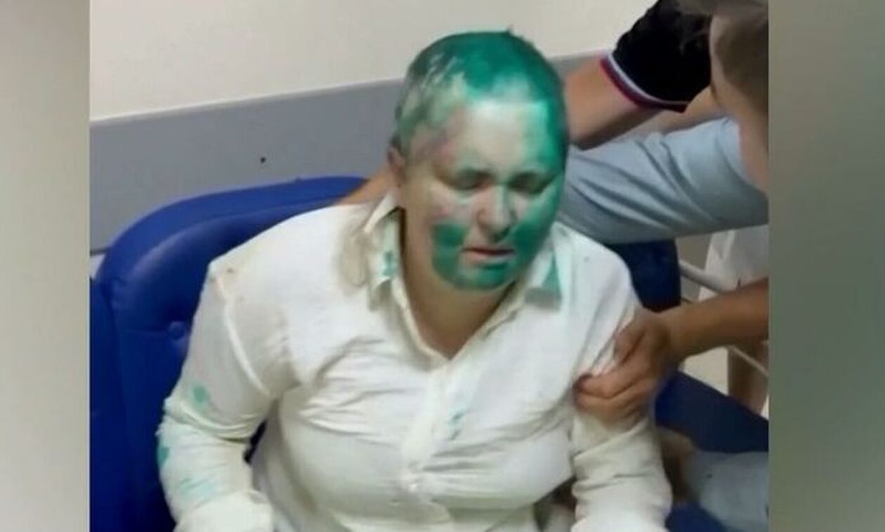 Άγρια επίθεση σε δημοσιογράφο - Την κούρεψαν γουλί και της έκοψαν τα δάχτυλα