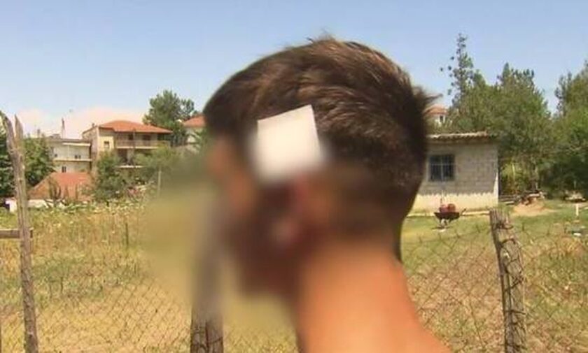 Χαλκιδική: «Ένιωσα μία σφαίρα και το κεφάλι μου γεμάτο αίματα» -Συγκλονίζει η μαρτυρία του 17χρονου