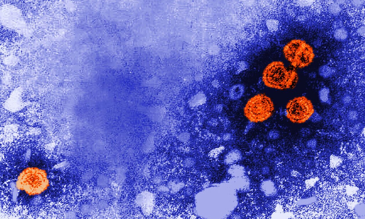 Παγκόσμια Ημέρα Ηπατίτιδας: Οι τρεις τύποι ιών που προκαλούν χρόνιες λοιμώξεις