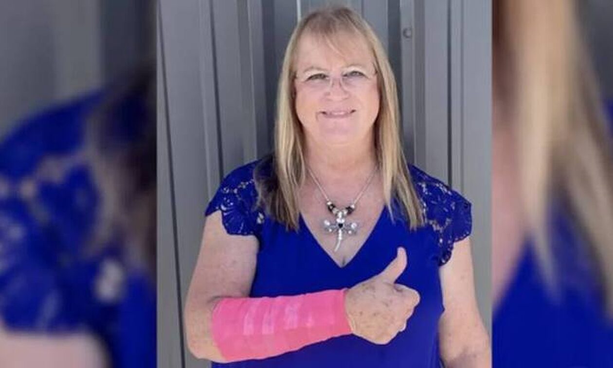 Απίστευτο περιστατικό στο Τέξας: Γυναίκα τραυματίστηκε σοβαρά απο φίδι...που έπεσε από γεράκι