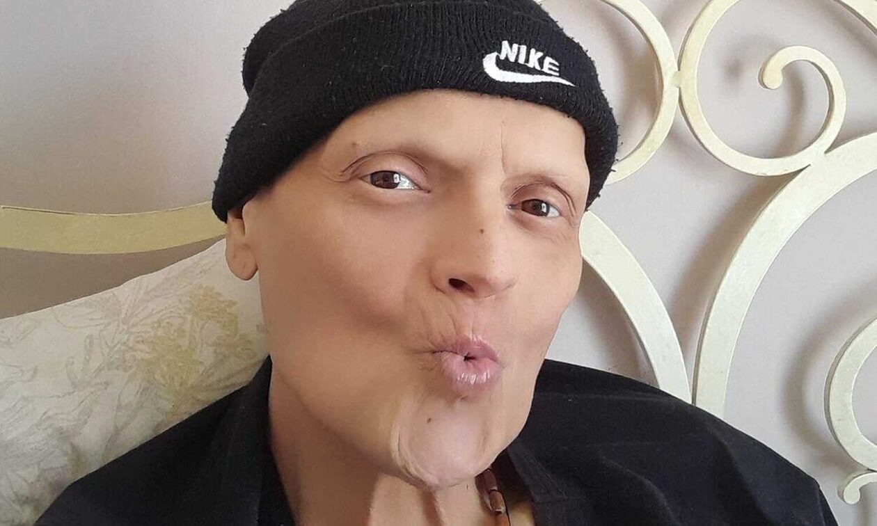 Γιώργος Δασκαλάκης για τον καρκίνο: «Μπορεί να πονάω και να κλαίω, μάντεψε ποιος θα νικήσει»