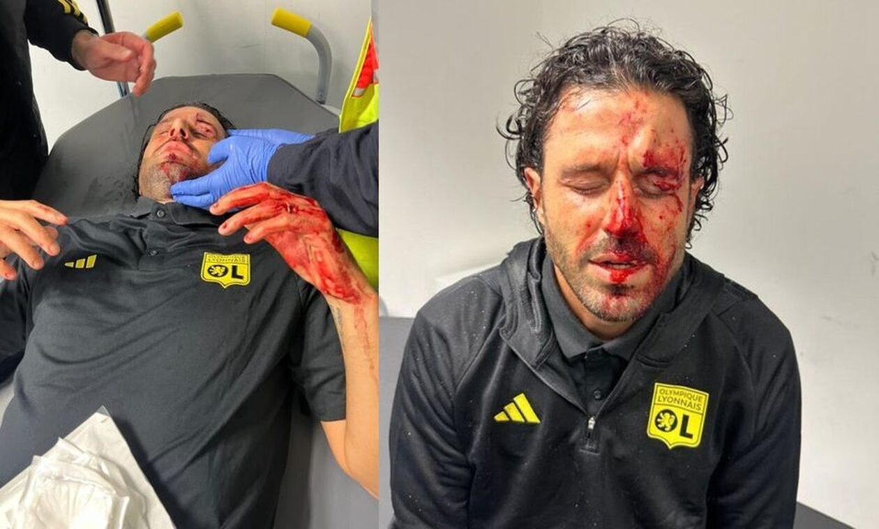 Αναβλήθηκε το Μαρσέιγ-Λιόν μετά την επίθεση και τον σοβαρό τραυματισμό του Γκρόσο - Σκληρές εικόνες