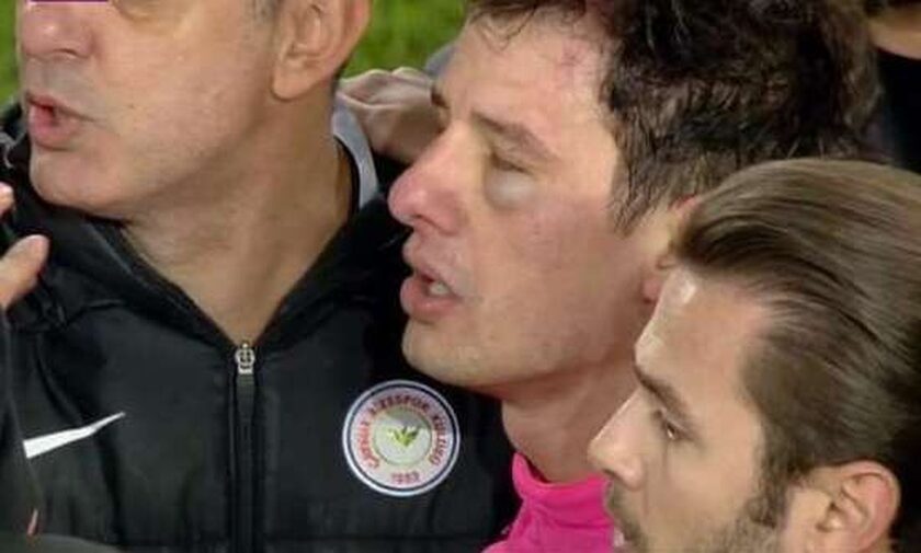 «Λουκέτο» στο πρωτάθλημα ποδοσφαίρου της Τουρκίας μετά τη βίαιη επίθεση σε διαιτητή