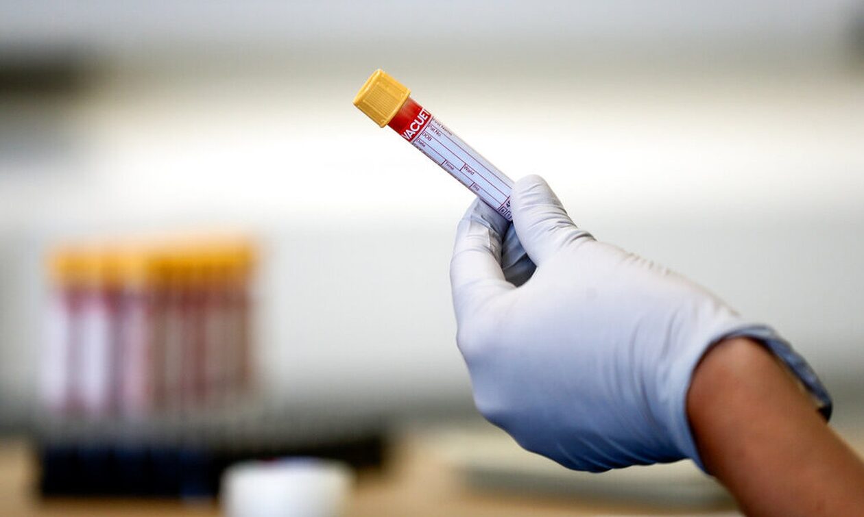 Τεστ DNA για θαλασσαιμία και σπάνιες αναιμίες - Καλύτερος έλεγχος των μεταγγίσεων