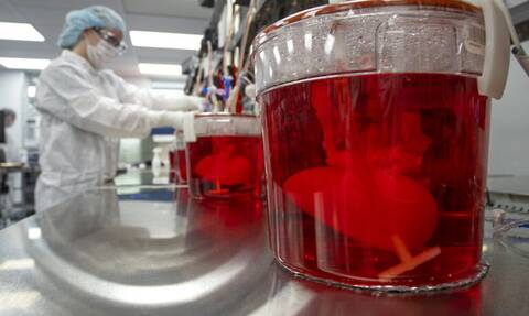 ΗΠΑ: Πέθανε ο πρώτος ασθενής που έλαβε γενετικά τροποποιημένο νεφρό από χοίρο