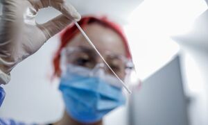 Παγκόσμιος συναγερμός: Εμφανίστηκε θανατηφόρος ιός στη Μεσόγειο - Τα συμπτώματα της νόσου Chagas
